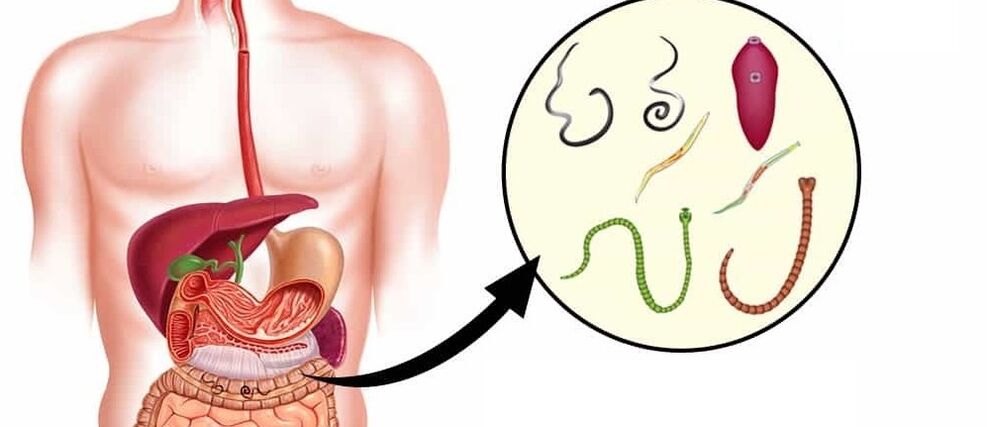 Parazity v ľudskom tele