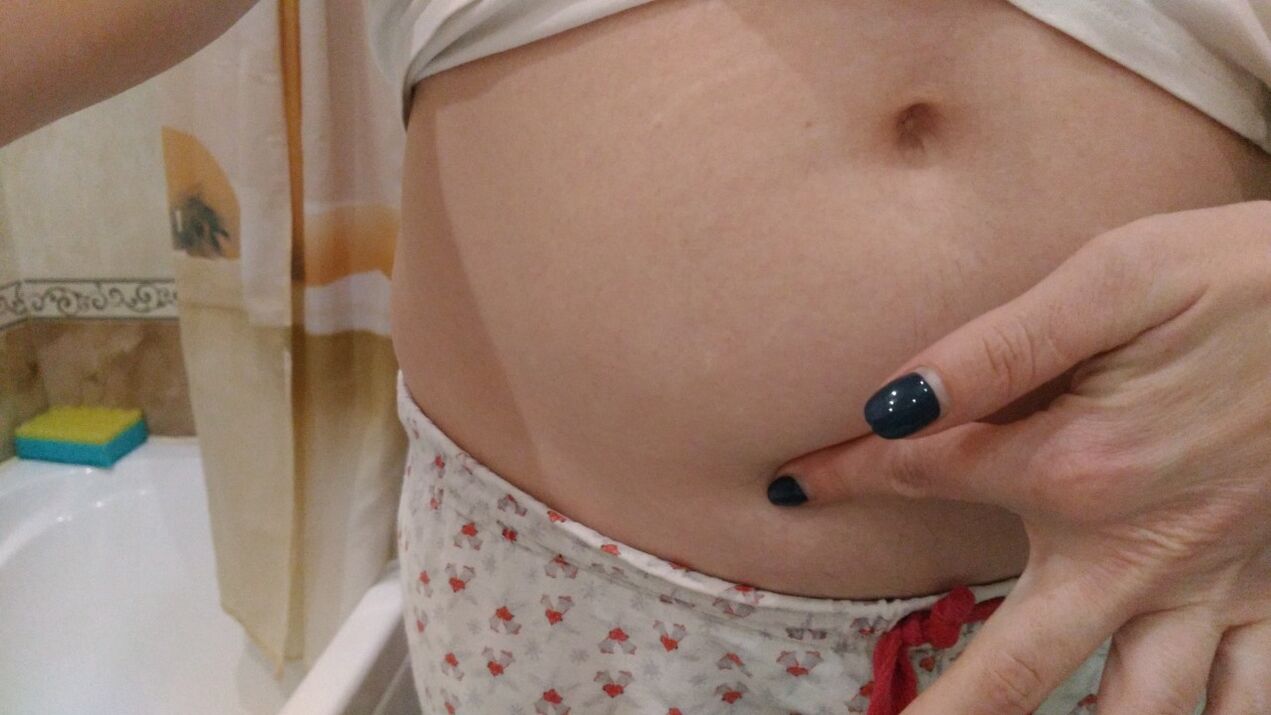 Príznaky helmintovej infekcie z osobnej skúsenosti