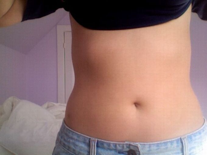 Výsledok liečby kapsulami NEOflorax