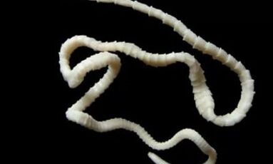 ako odstrániť parazita cestodu z tela